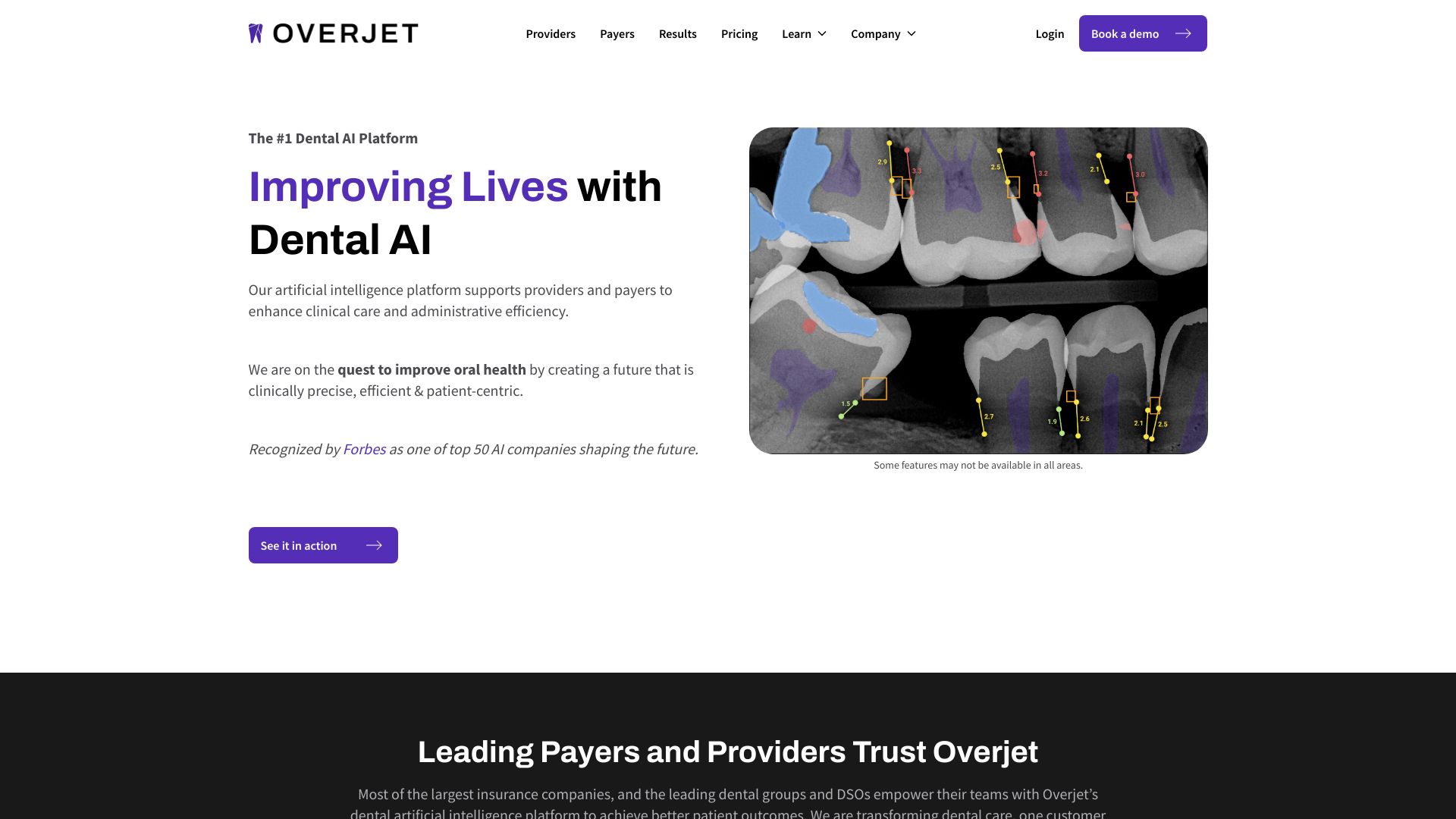Overjet screenshot